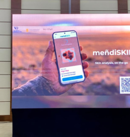 Қазақстандық жастар тері обырын ерте анықтауға көмектесетін MendiSkin қосымшасын жасады